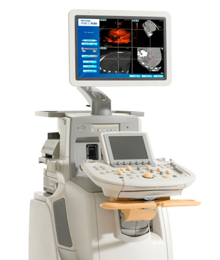 ULTRASOUND SCANNERS ULTRASOUND SCANNERS