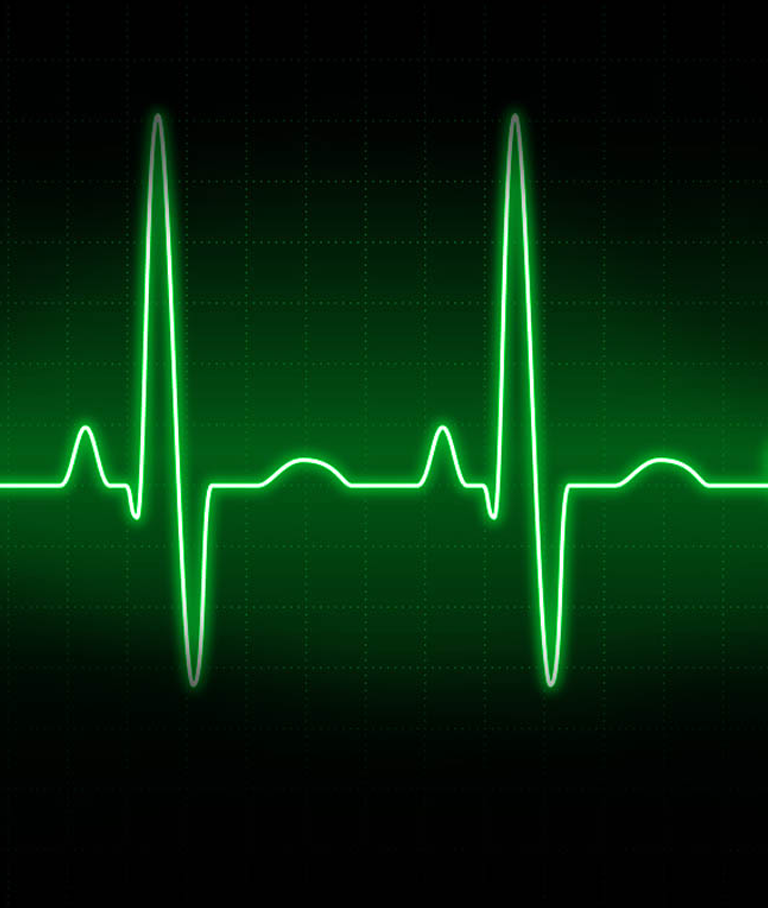 ECG ECG